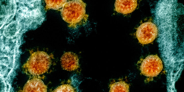 LIVE: Austin Public Health discusses local outbreak after President Trump tests positive for COVID-19