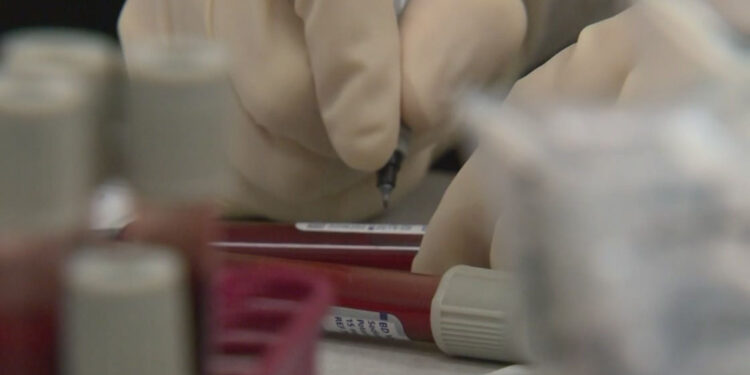 Possible changes to how Austin police investigate sexual assault cases